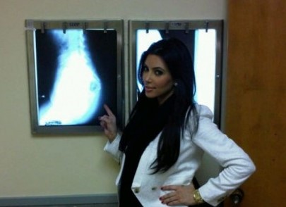 Kim KardASSian vie, �o m�me na nej najrad�ej