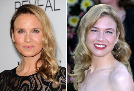 Denn�k plastick�ch oper�ci� Brigitte Jonesovej