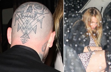 Benji Madden si potetoval hlavu